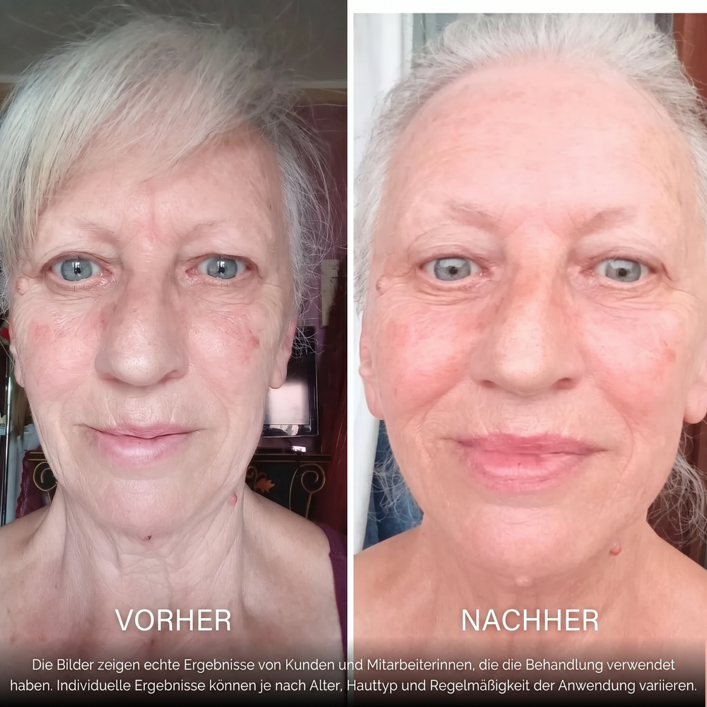 Natürlich vollere und definiertere Lippen